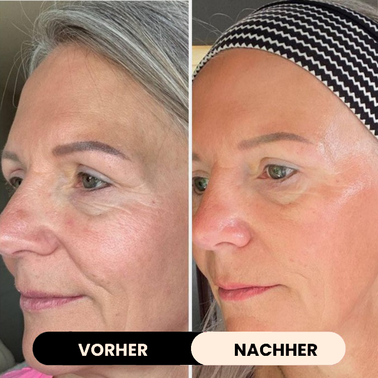 GETLUMORYA® - Beauty Kollagen Maske